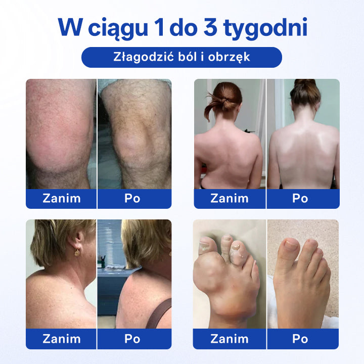 🔥Timilk® BPC-157 Żel w kulce do regeneracji stawów i kości