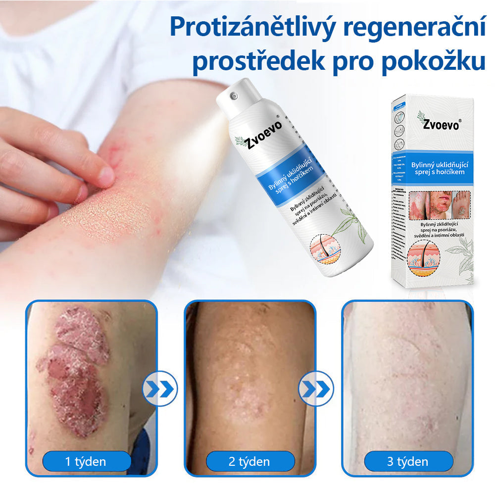【Oficiální značkový obchod】✅Zvoevo® Magnesium bylinný sprej ⚕️ Certifikace MHRA – úleva při psoriáze, ekzému, intimních bakteriálních infekcích, akné a tmavých skvrnách