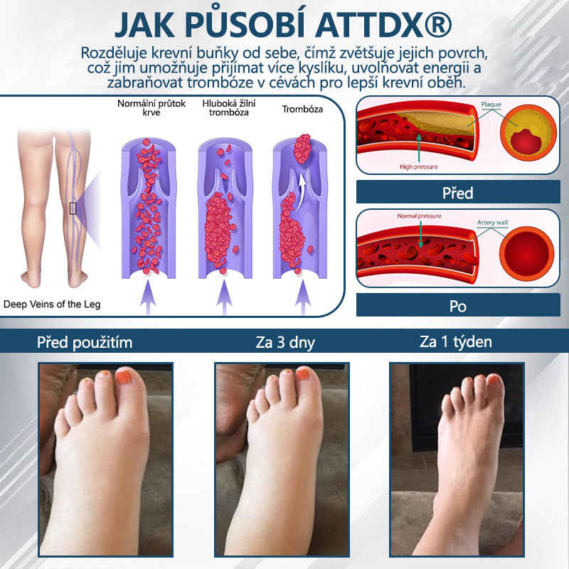 💧💧💧ATTDX® Bylinný krém na zmírnění otoků s černou natí
