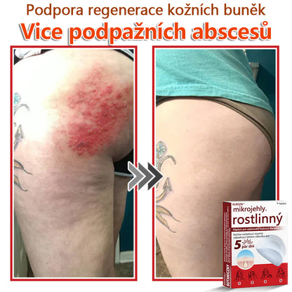 🔥🔥🔥KUBOZN® Mikroneedle Botanické náplasti na odstranění kožních výrůstků | Vyrobeno v České republice