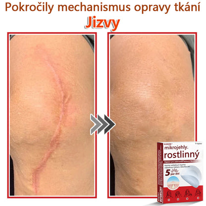 🔥🔥🔥KUBOZN® Mikroneedle Botanické náplasti na odstranění kožních výrůstků | Vyrobeno v České republice