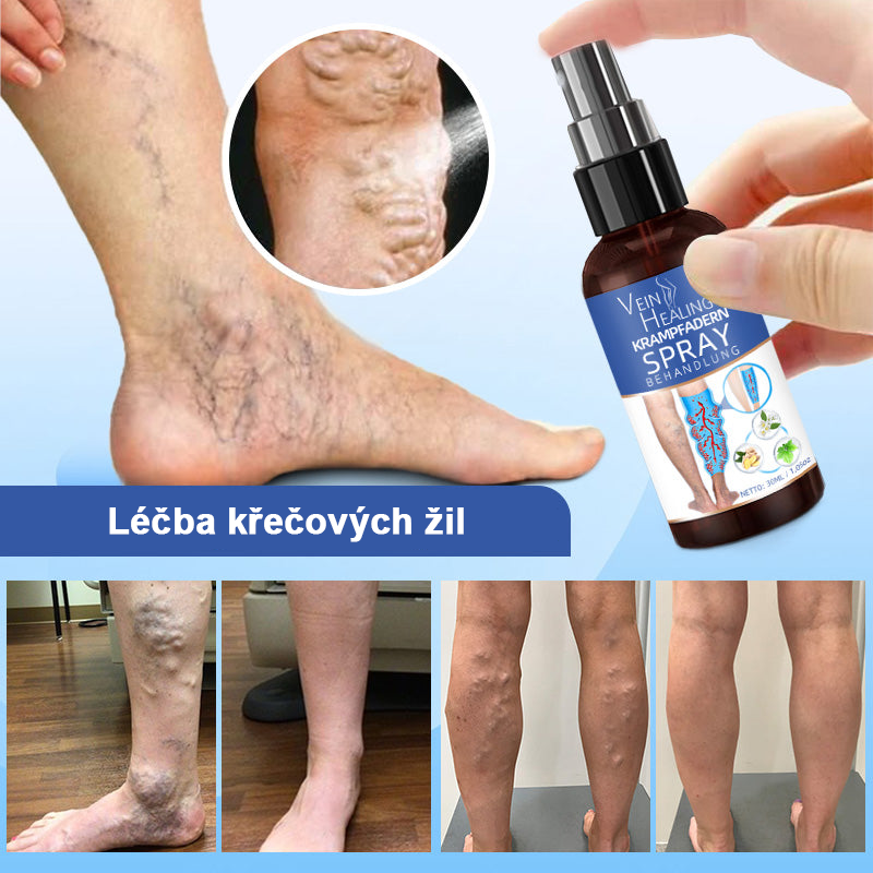 🌱🌠✨Sprej na léčbu křečových žil Veinhealing™🌿🌿