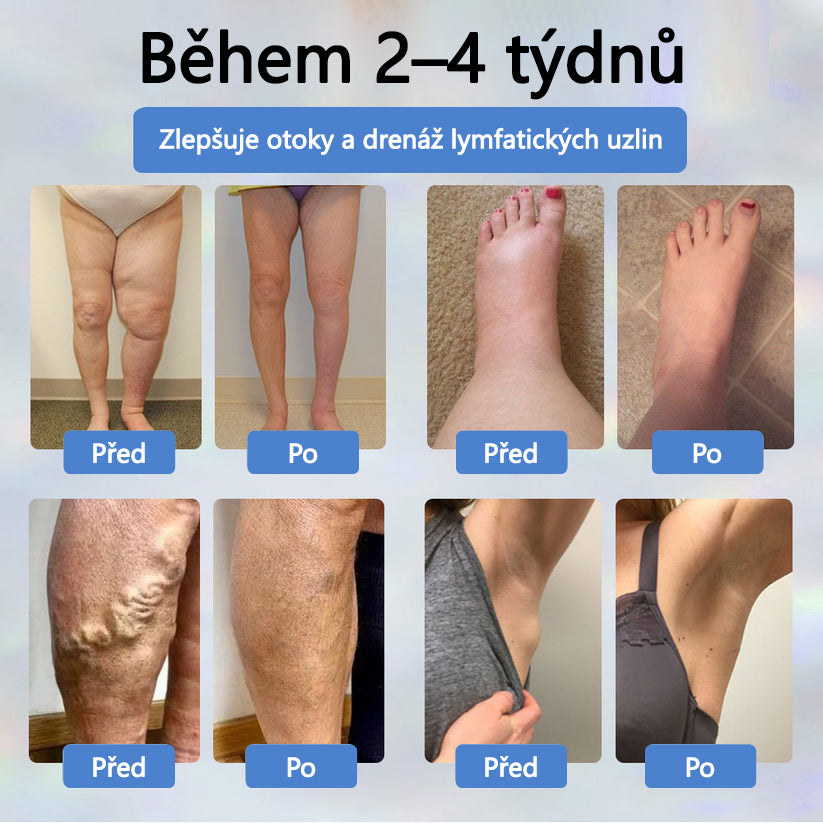 💧💧💧ATTDX® Bylinný krém na zmírnění otoků s černou natí