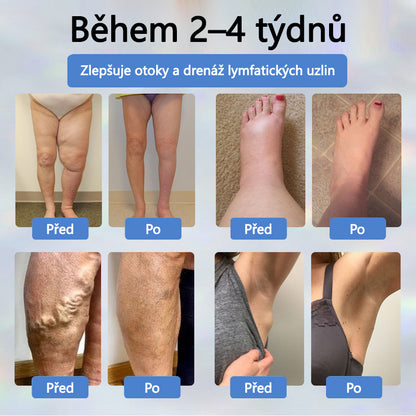 💧💧💧ATTDX® Bylinný krém na zmírnění otoků s černou natí