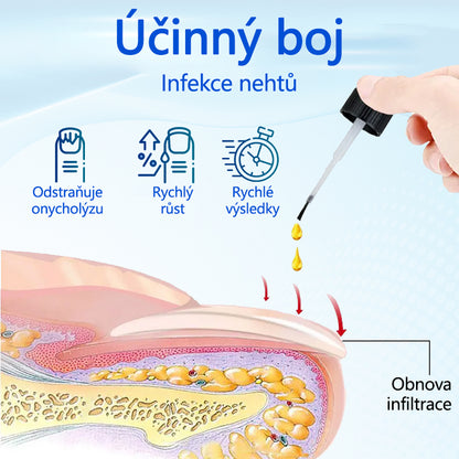 Biancat® OnyxoGuard Sérum pro růst a regeneraci nehtů🔥