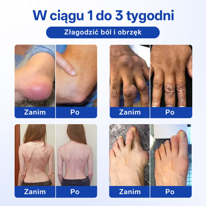 🔥Timilk® BPC-157 Żel w kulce do regeneracji stawów i kości