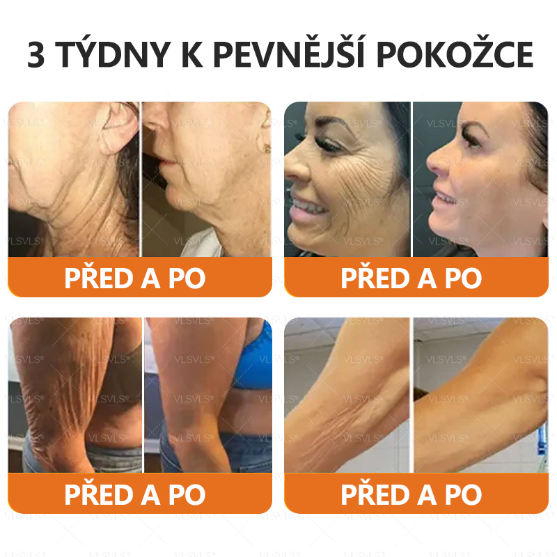 Vyrobeno a odesláno z České republiky ✨✨Foulme® Obnovující krém se včelím jedem ⏰ POSLEDNÍ DEN SLEVA 80%