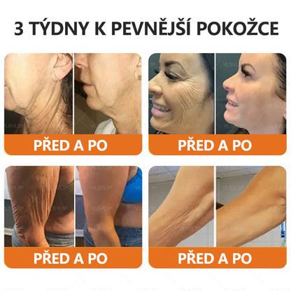 Vyrobeno a odesláno z České republiky ✨✨Foulme® Obnovující krém se včelím jedem ⏰ POSLEDNÍ DEN SLEVA 80%