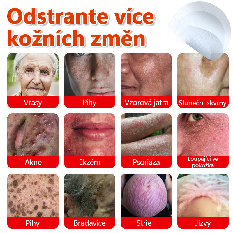 🔥🔥🔥KUBOZN® Mikroneedle Botanické náplasti na odstranění kožních výrůstků | Vyrobeno v České republice