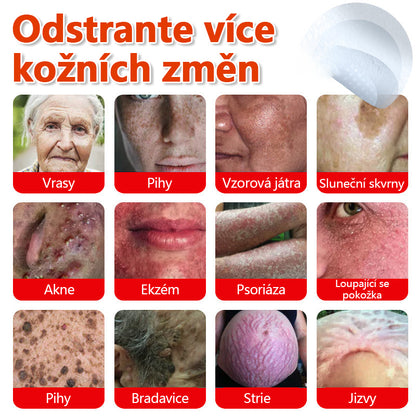 🔥🔥🔥KUBOZN® Mikroneedle Botanické náplasti na odstranění kožních výrůstků | Vyrobeno v České republice