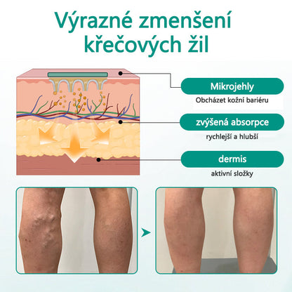 Timilk® Náplast na křečové žíly pro obnovu nohou⭐⭐