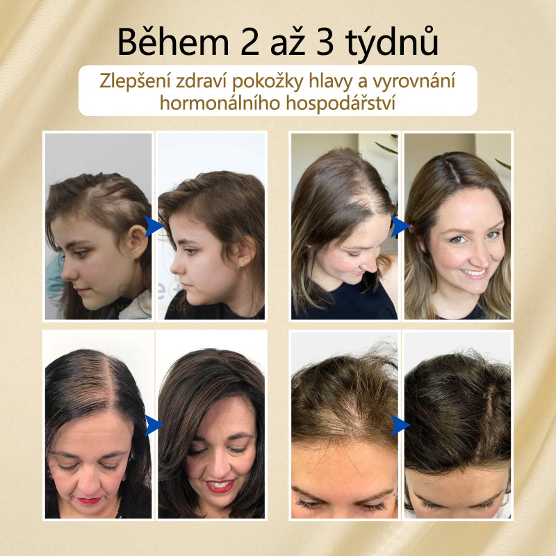 Timilk® VitaStrand Biotin Hair Growth Spray✅ Husté, lesklé vlasy za pouhých několik týdnů