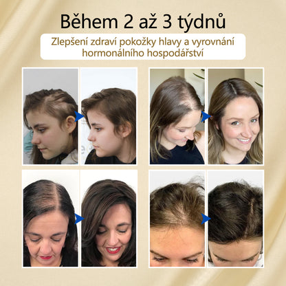 Timilk® VitaStrand Biotin Hair Growth Spray✅ Husté, lesklé vlasy za pouhých několik týdnů