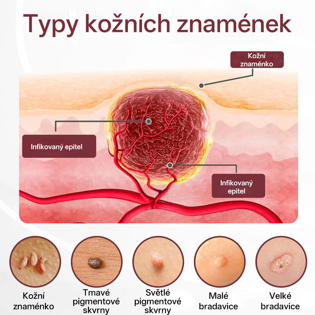 🔥🔥Biancat®KeraErase Krém s dvojím účinkem pro obnovu vlasů
