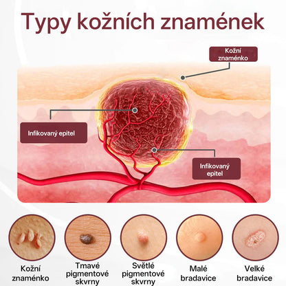 🔥🔥Biancat®KeraErase Krém s dvojím účinkem pro obnovu vlasů