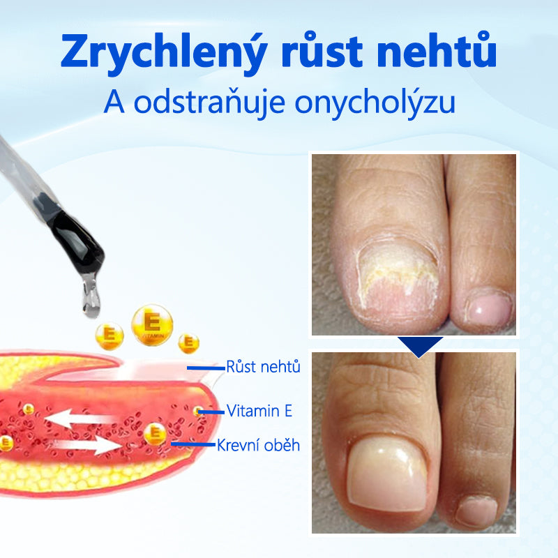 Biancat® OnyxoGuard Sérum pro růst a regeneraci nehtů🔥