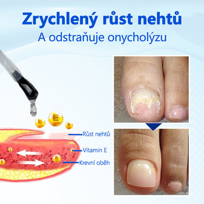 Biancat® OnyxoGuard Sérum pro růst a regeneraci nehtů🔥