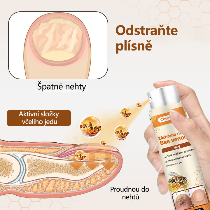 【Oficiální vlajkový obchod】Ceoerty® NailRescue Včelí jed ve spreji✅✅✅
