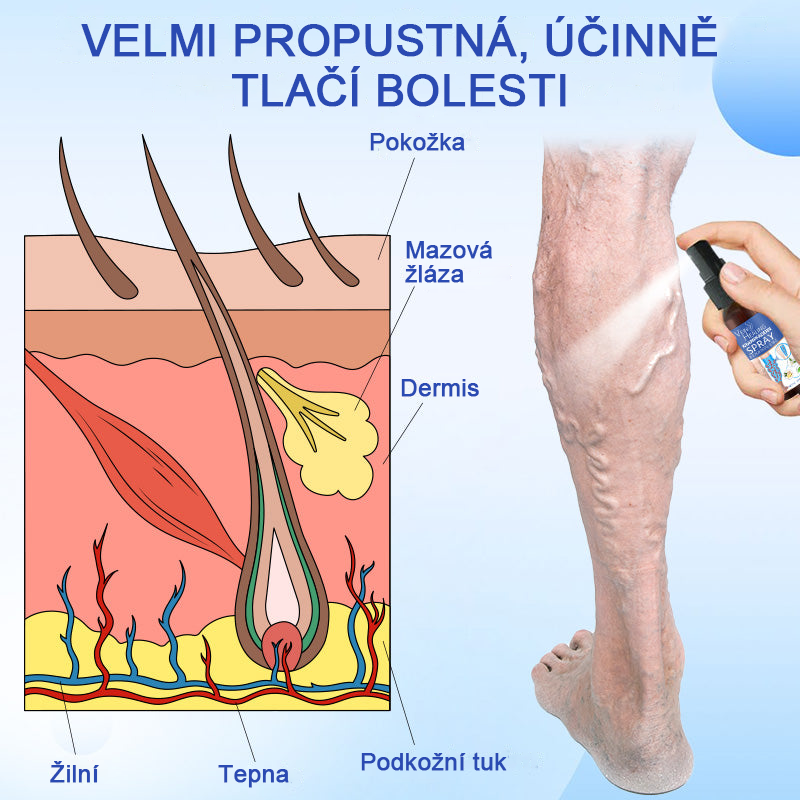 🌱🌠✨Sprej na léčbu křečových žil Veinhealing™🌿🌿