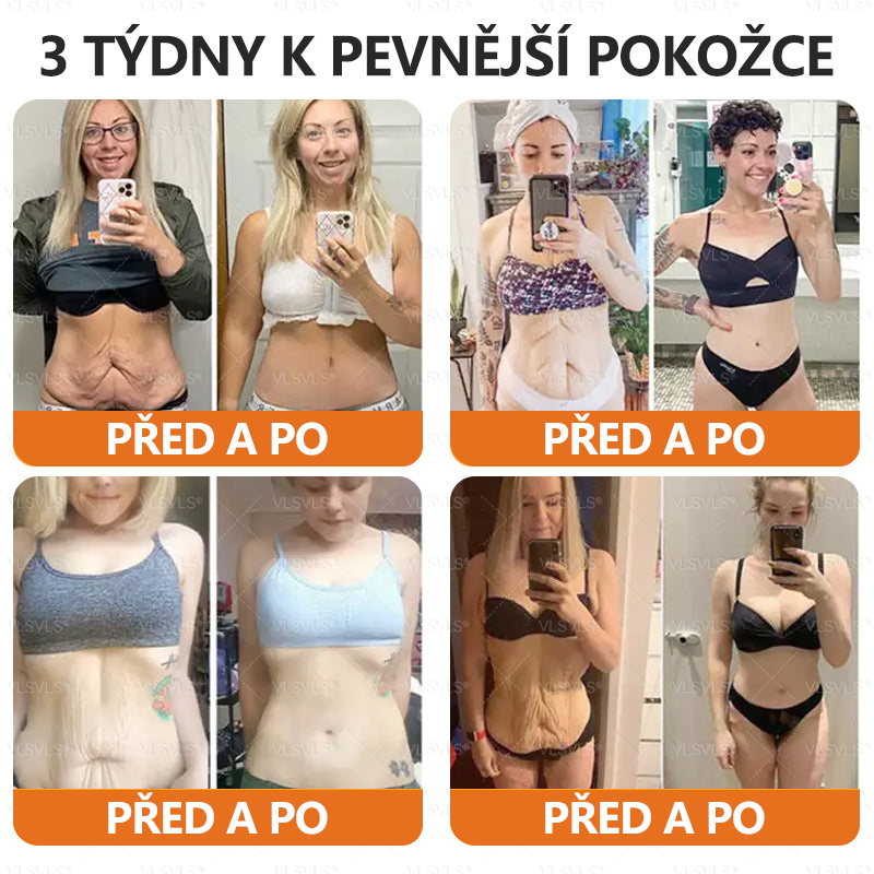 Vyrobeno a odesláno z České republiky ✨✨Foulme® Obnovující krém se včelím jedem ⏰ POSLEDNÍ DEN SLEVA 80%