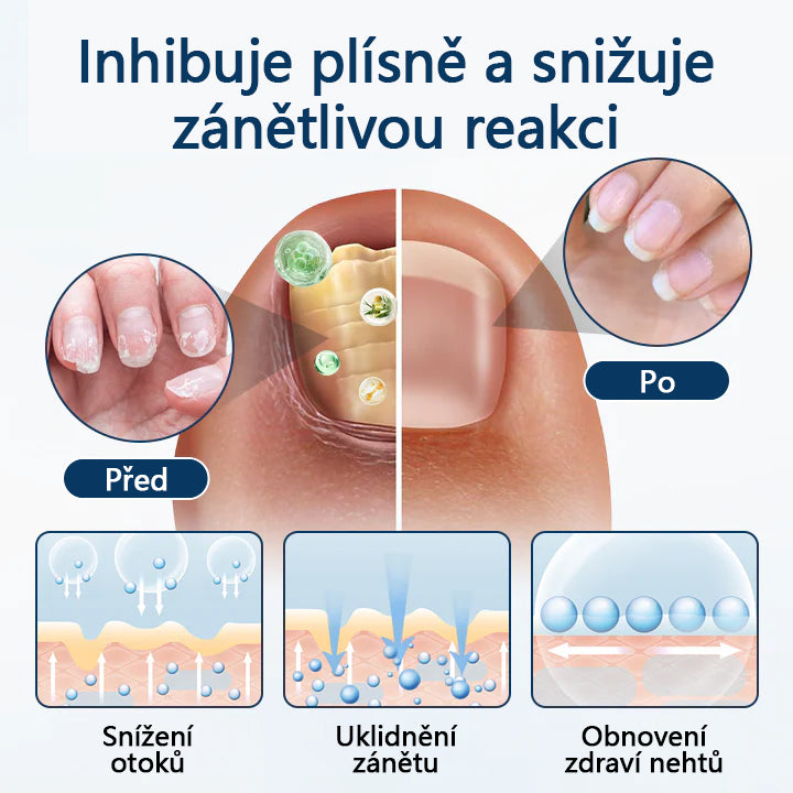 🔥🔥🔥🔥Bylinný sprej proti plísním Timilk® OnyxiGuard