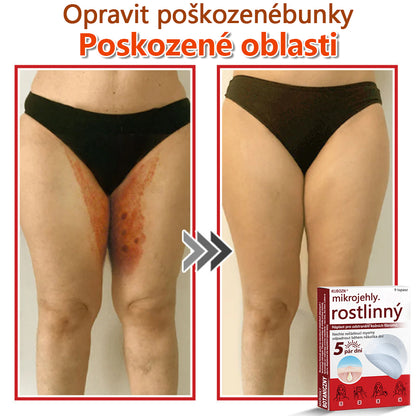 🔥🔥🔥KUBOZN® Mikroneedle Botanické náplasti na odstranění kožních výrůstků | Vyrobeno v České republice