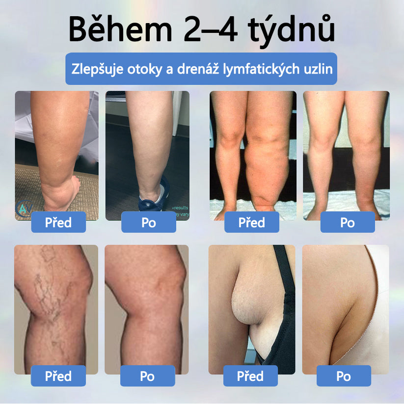 💧💧💧ATTDX® Bylinný krém na zmírnění otoků s černou natí