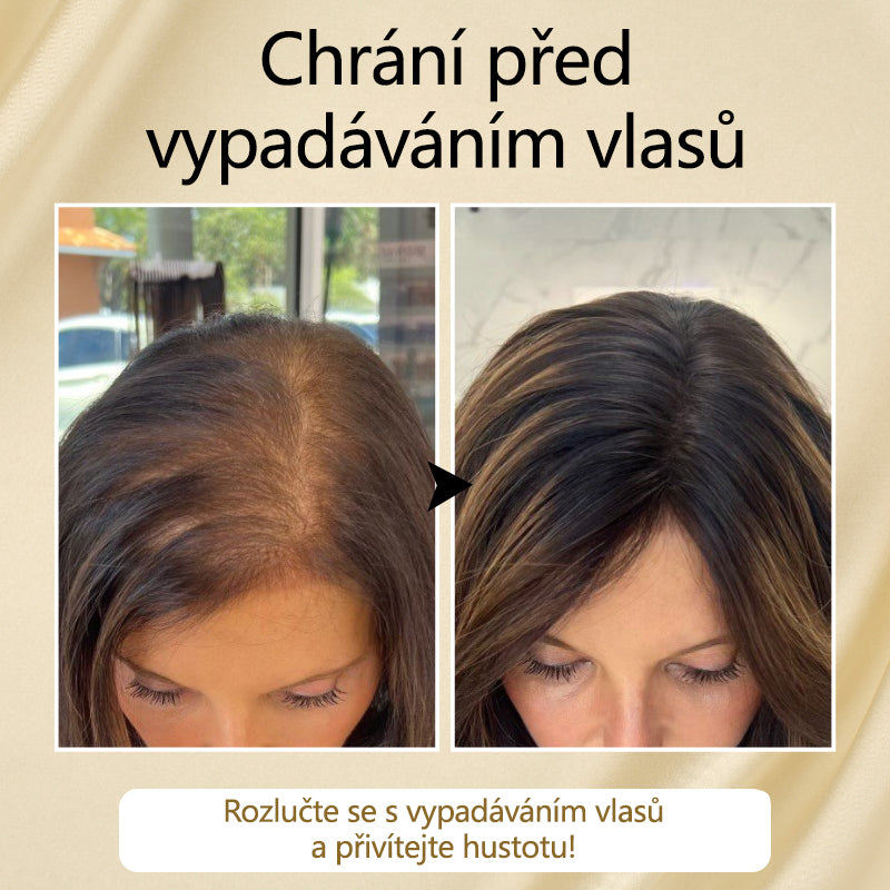 Timilk® VitaStrand Biotin Hair Growth Spray✅ Husté, lesklé vlasy za pouhých několik týdnů