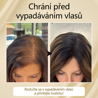 Timilk® VitaStrand Biotin Hair Growth Spray✅ Husté, lesklé vlasy za pouhých několik týdnů