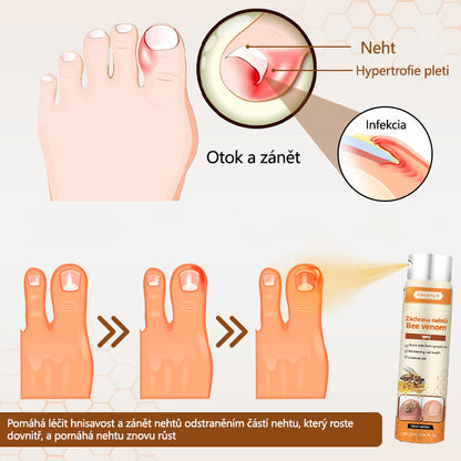 【Oficiální vlajkový obchod】Ceoerty® NailRescue Včelí jed ve spreji✅✅✅
