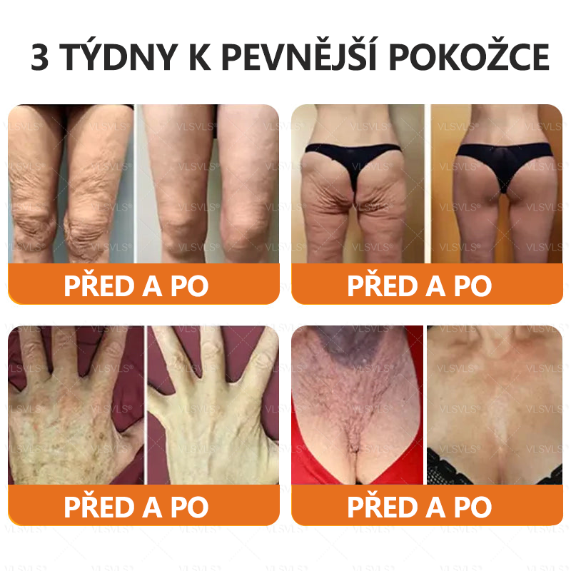 Vyrobeno a odesláno z České republiky ✨✨Foulme® Obnovující krém se včelím jedem ⏰ POSLEDNÍ DEN SLEVA 80%