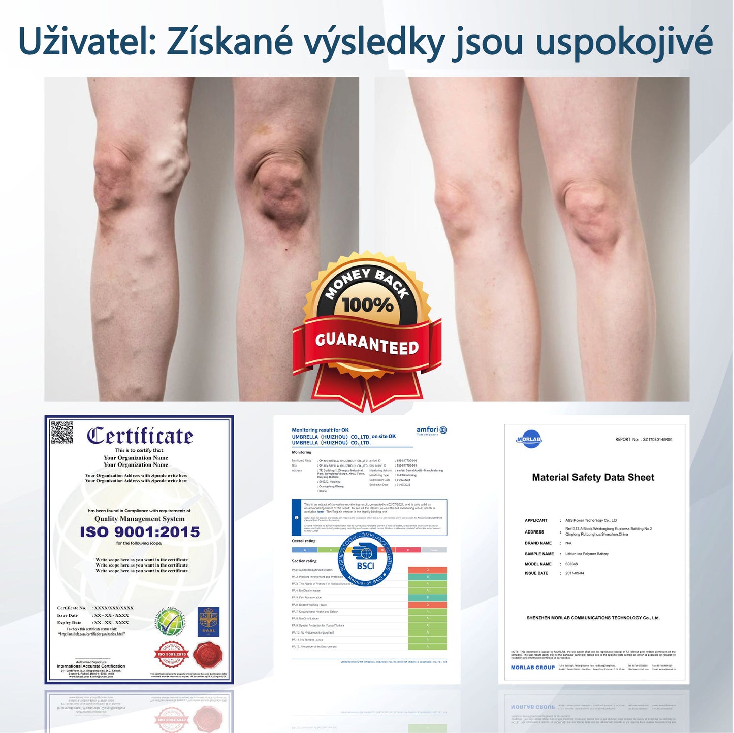 💧💧💧ATTDX® Bylinný krém na zmírnění otoků s černou natí