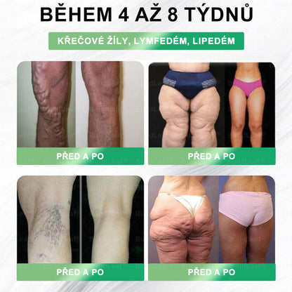 🌿Omezené zásoby! BuildLeaf®🎁Extra sleva 30 %! Obnovte své tělo a zdraví. Nenechte si to ujít.🎁🎁🎁🎁