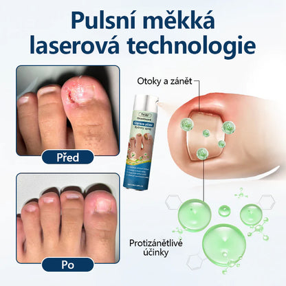 🔥🔥🔥🔥Bylinný sprej proti plísním Timilk® OnyxiGuard