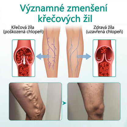 Timilk® Náplast na křečové žíly pro obnovu nohou⭐⭐