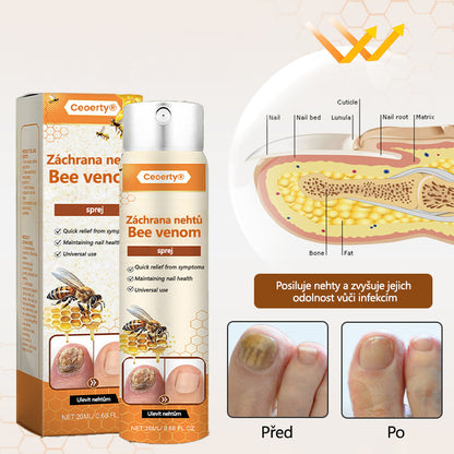 【Oficiální vlajkový obchod】Ceoerty® NailRescue Včelí jed ve spreji✅✅✅