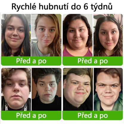 HHVB® GLP-1 kapky na hubnutí pro podporu zdraví👨‍⚕️ (Spalovač tuků z potravin - vyvinuto Českou asociací proti obezitě)👨‍⚕️👨‍⚕️