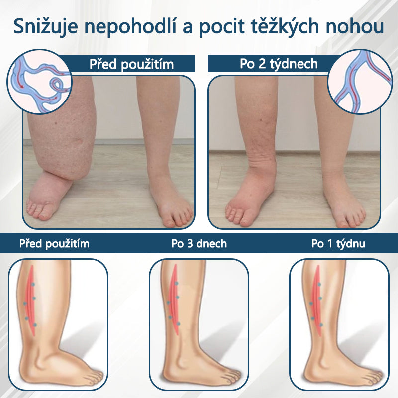 💧💧💧ATTDX® Bylinný krém na zmírnění otoků s černou natí