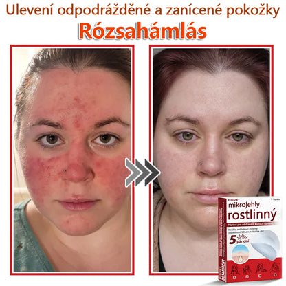 🔥🔥🔥KUBOZN® Mikroneedle Botanické náplasti na odstranění kožních výrůstků | Vyrobeno v České republice