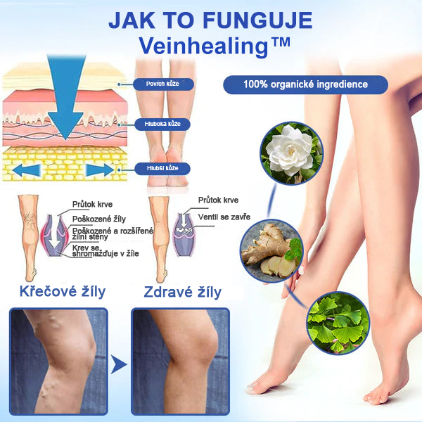 🌱🌠✨Sprej na léčbu křečových žil Veinhealing™🌿🌿