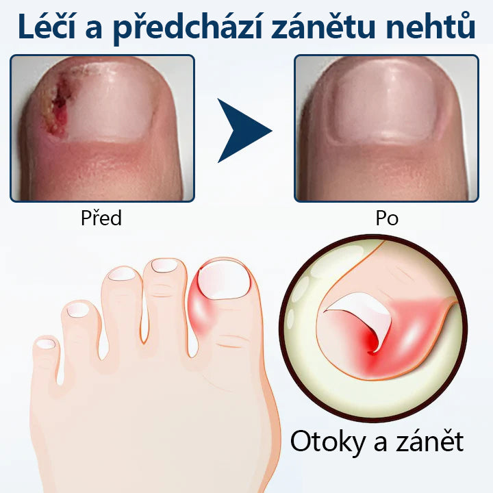 🔥🔥🔥🔥Bylinný sprej proti plísním Timilk® OnyxiGuard