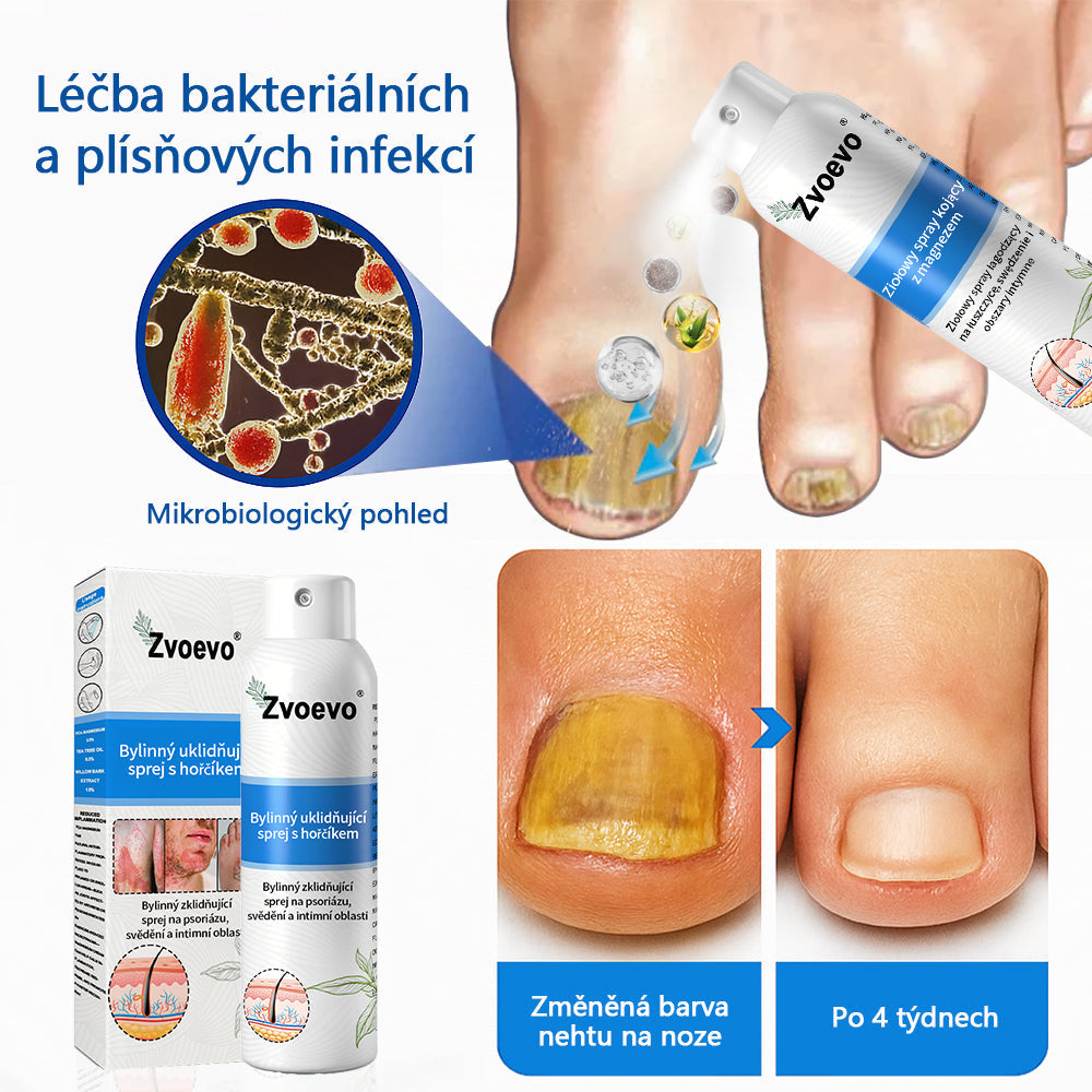 【Oficiální značkový obchod】✅Zvoevo® Magnesium bylinný sprej ⚕️ Certifikace MHRA – úleva při psoriáze, ekzému, intimních bakteriálních infekcích, akné a tmavých skvrnách