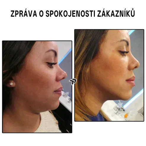 (Poslední den výprodeje – 80% sleva) Náušnice Bikenda™ Lymphvity MagneTherapy🔥