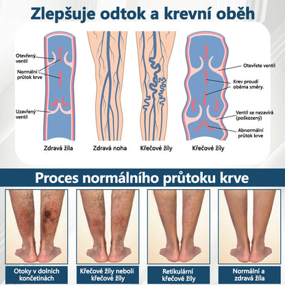 💧💧💧ATTDX® Bylinný krém na zmírnění otoků s černou natí