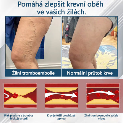 💧💧💧ATTDX® Bylinný krém na zmírnění otoků s černou natí