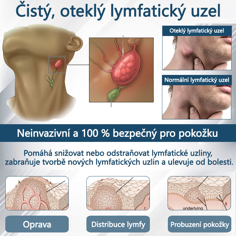 💧💧💧ATTDX® Bylinný krém na zmírnění otoků s černou natí