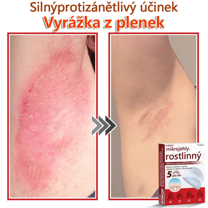 🔥🔥🔥KUBOZN® Mikroneedle Botanické náplasti na odstranění kožních výrůstků | Vyrobeno v České republice