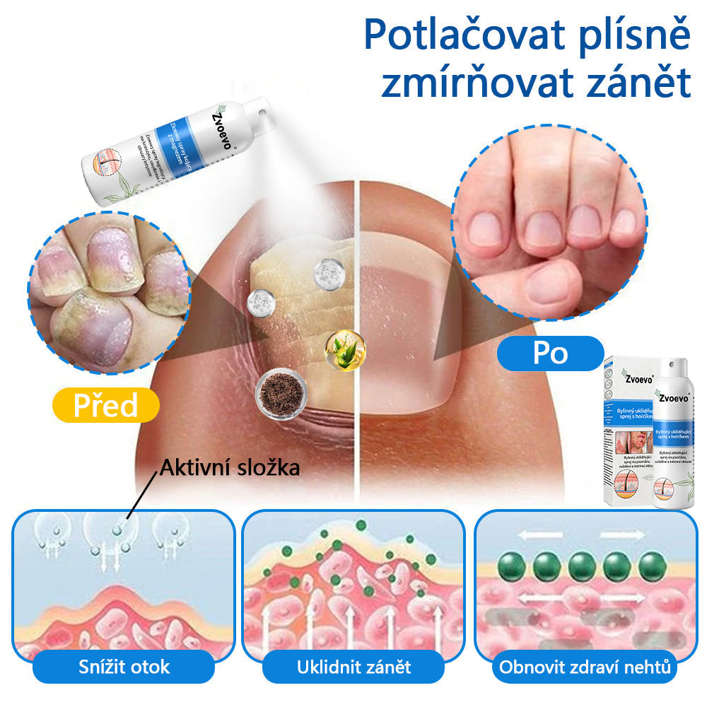 【Oficiální značkový obchod】✅Zvoevo® Magnesium bylinný sprej ⚕️ Certifikace MHRA – úleva při psoriáze, ekzému, intimních bakteriálních infekcích, akné a tmavých skvrnách