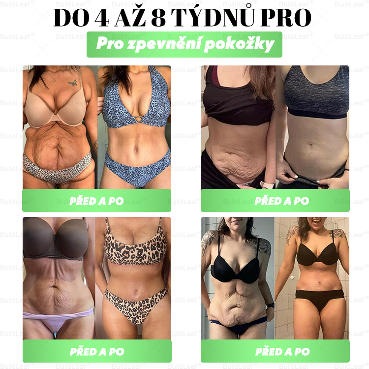 🌿Omezené zásoby! BuildLeaf®🎁Extra sleva 30 %! Obnovte své tělo a zdraví. Nenechte si to ujít.🎁🎁🎁🎁